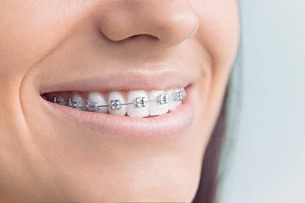 Best Full Mouth Reconstruction  in Brighton, IL
